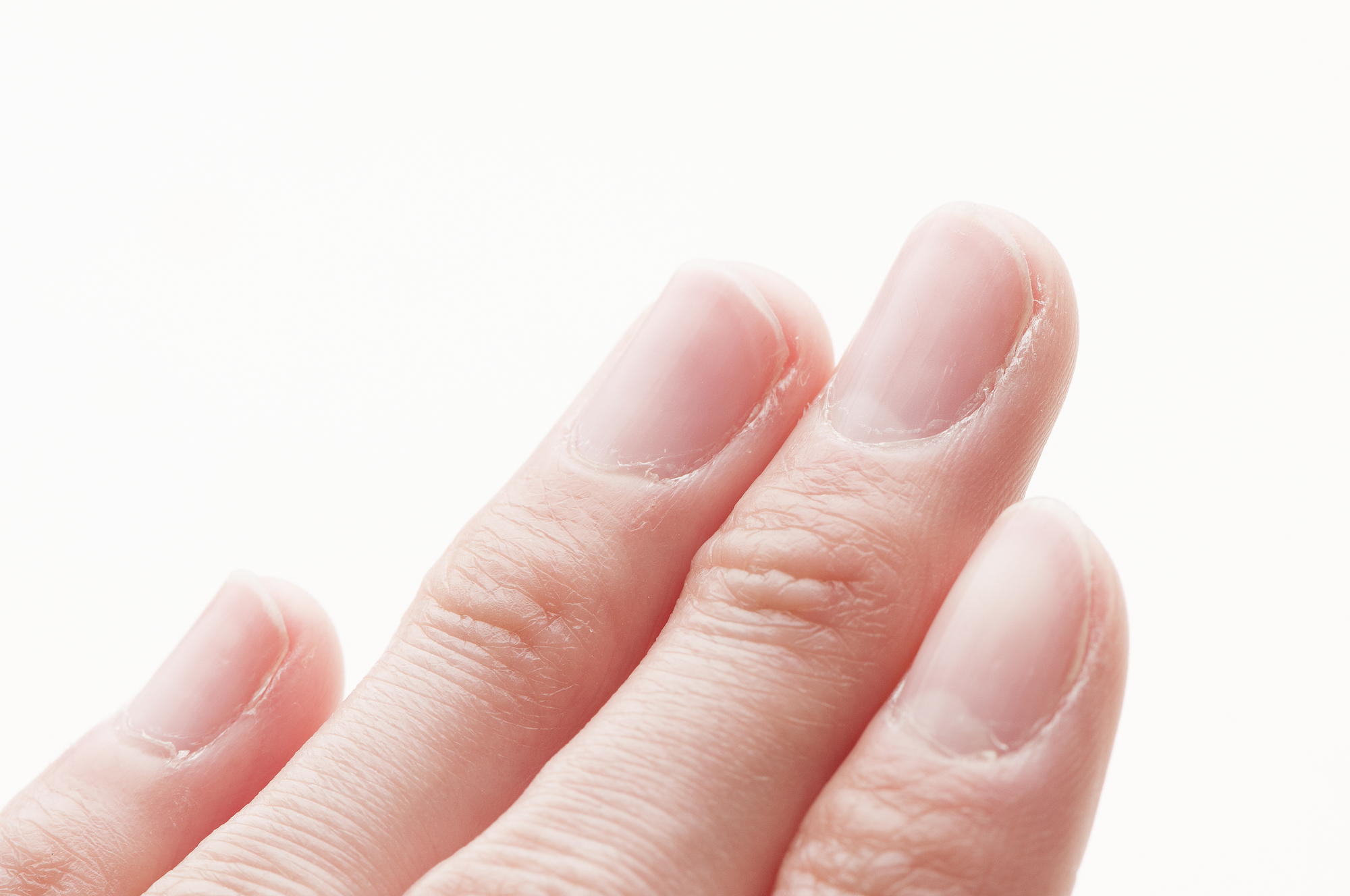 脱チビ爪 爪のピンクの部分を伸ばす方法 をご紹介します Stylelog スタイルログ